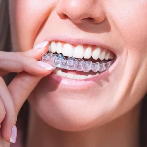 https://hypeready-admin-prod.s3.amazonaws.com/closebi-prod/Aligners-aligners