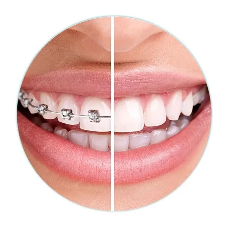 https://hypeready-admin-prod.s3.amazonaws.com/closebi-prod/Orthodontics-orthodontics